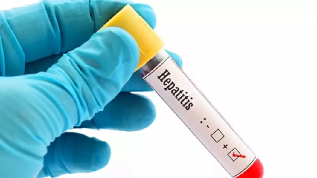 hepatitis aguda niños