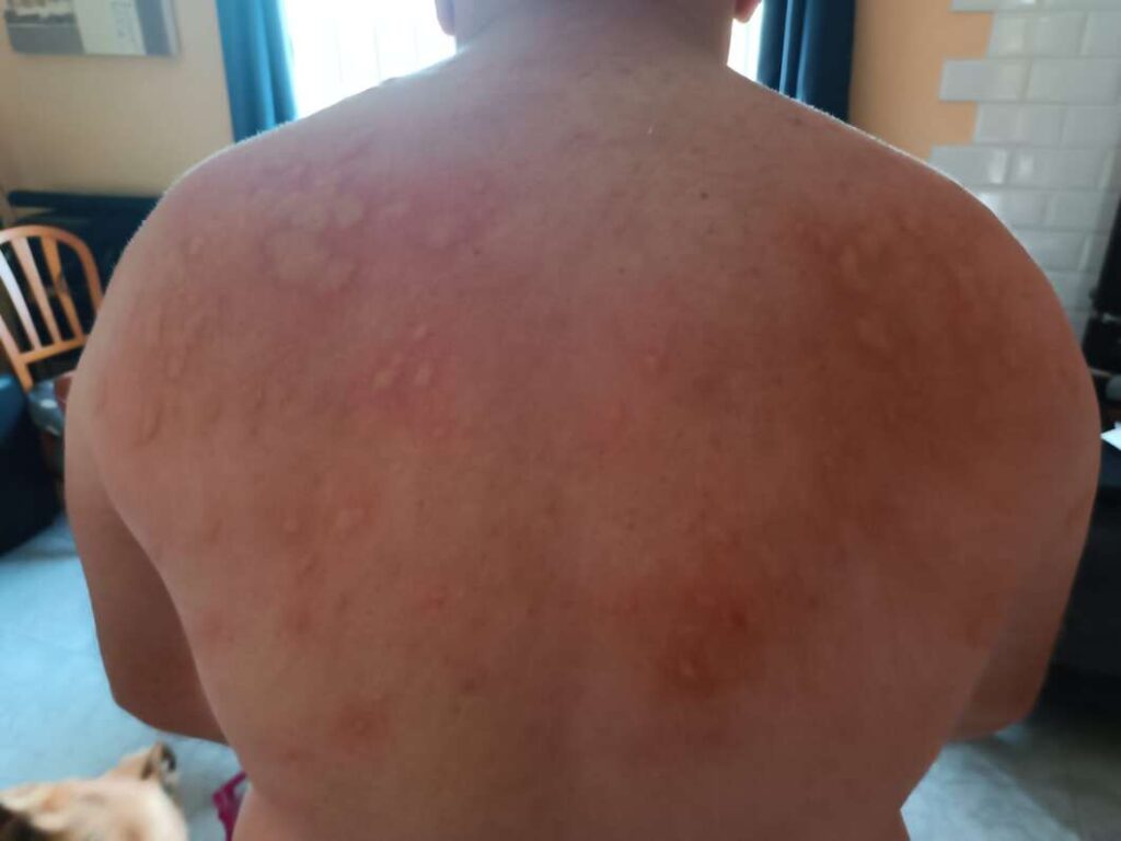 Marjalería de Castelló mosquitos