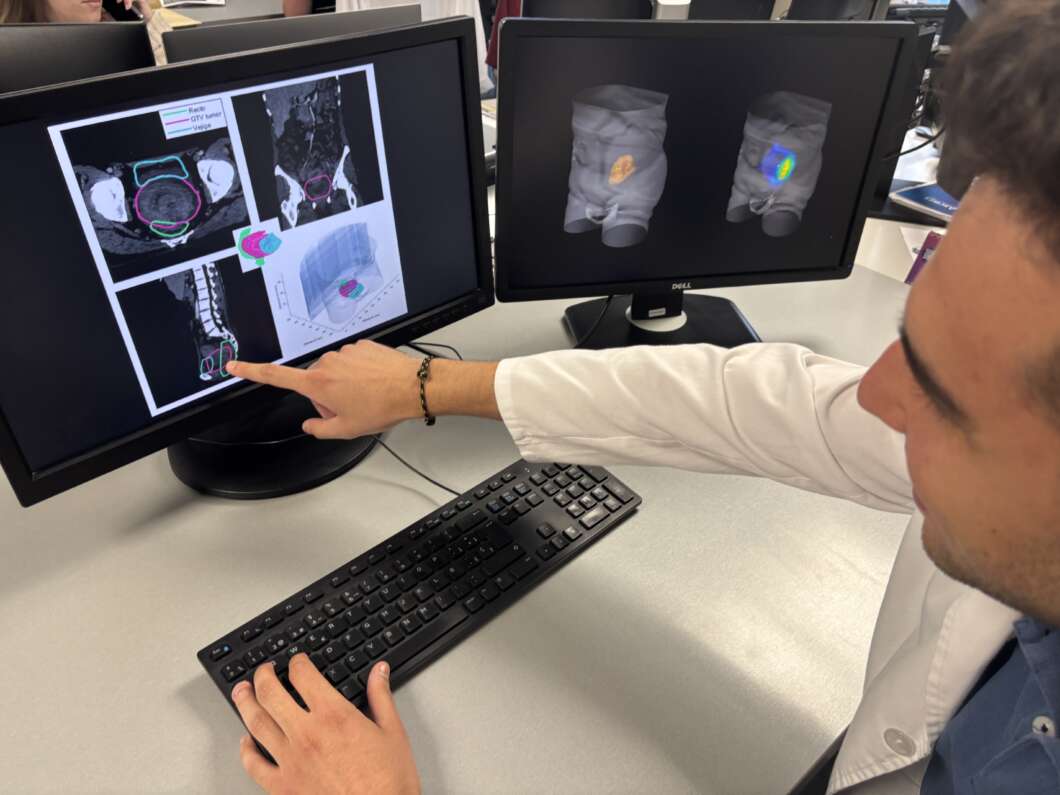 Ivace+i impulsa un software innovador para mejorar la radioterapia en tumores complejos